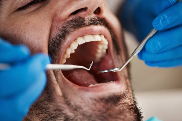 Best Walk-In Emergency Dental Services in Blue Island, IL